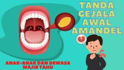 Tanda Awal Radang Amandel yang Perlu Diwaspadai: Panduan Lengkap untuk Kesehatan Tenggorokan Anda