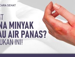Mengapa Minyak Tawon Menimbulkan Sensasi Panas di Kulit? Penjelasan Medis dan Panduan Penggunaannya
